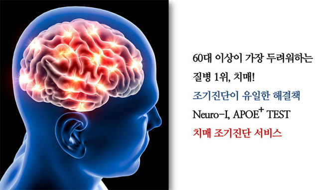 치매 조기 진단